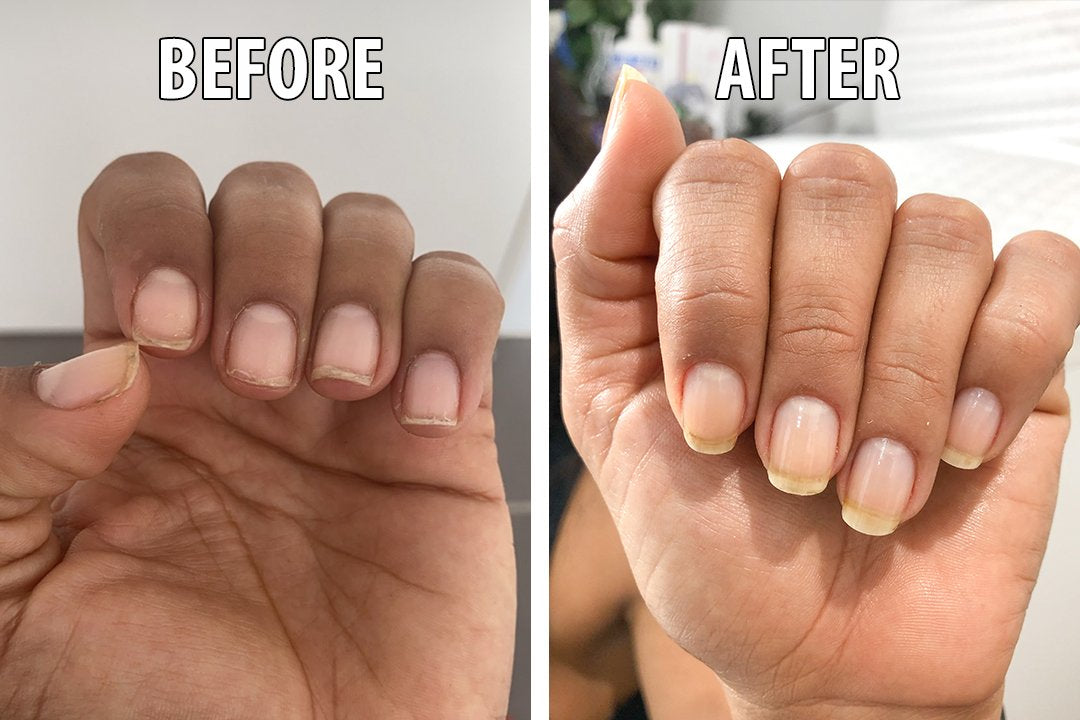 6 Tips for Naturally and Healthly Beautiful Nails